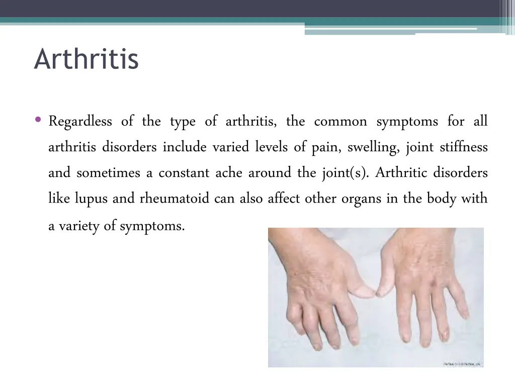arthritis 3