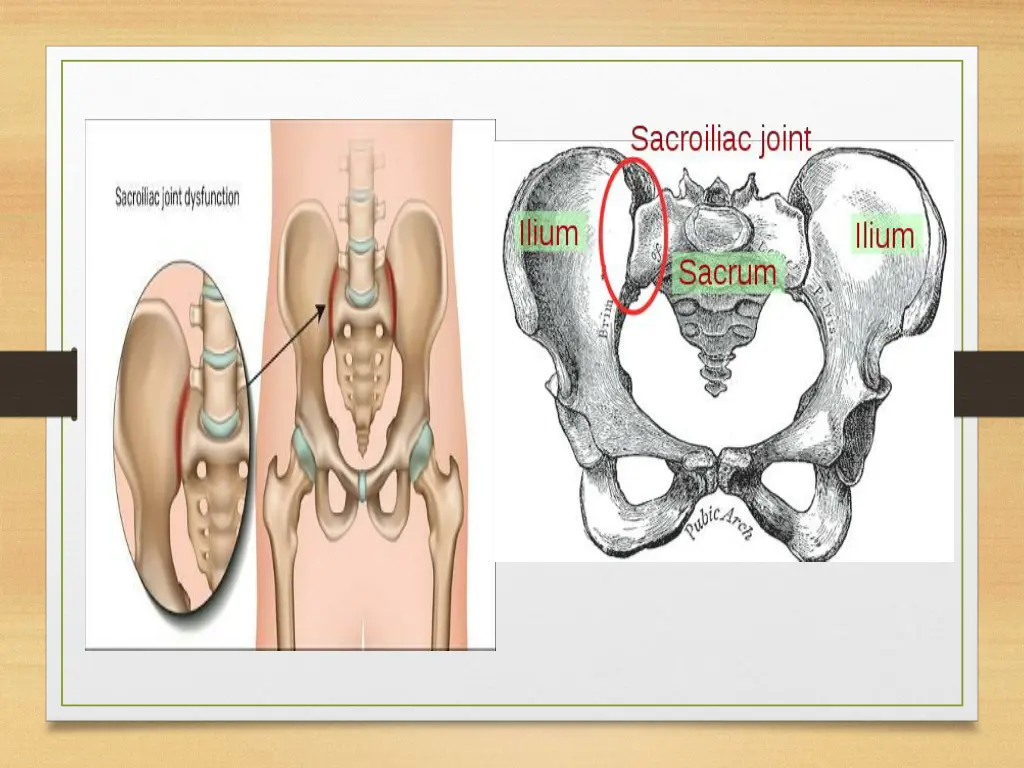 slide3
