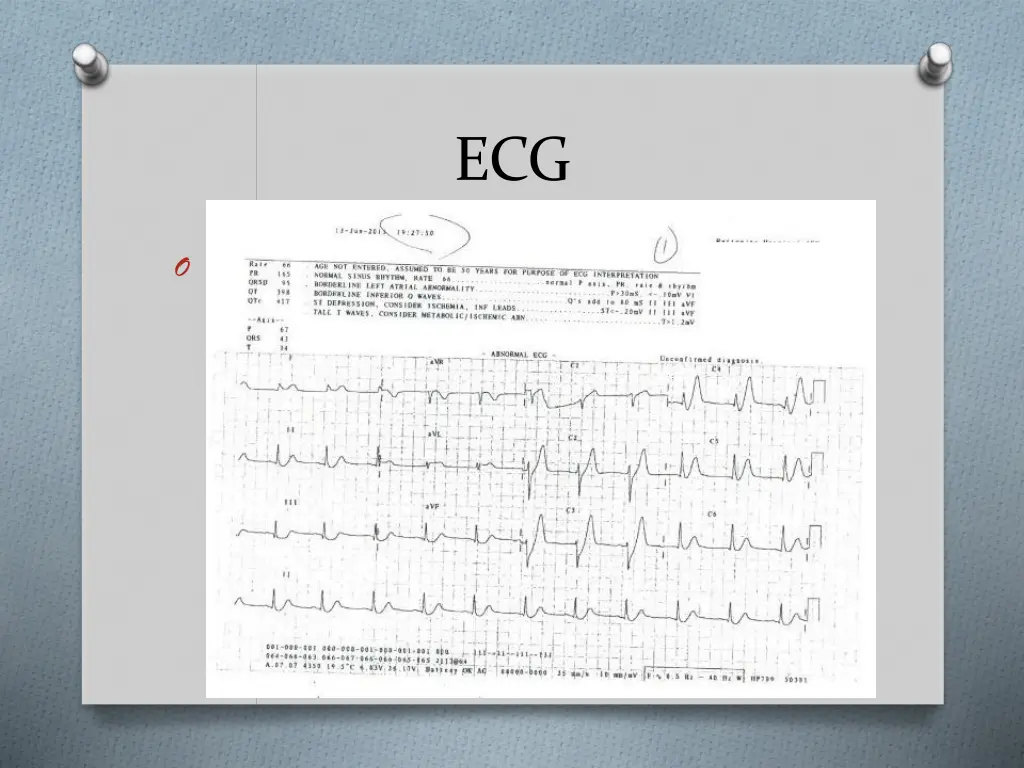 slide17