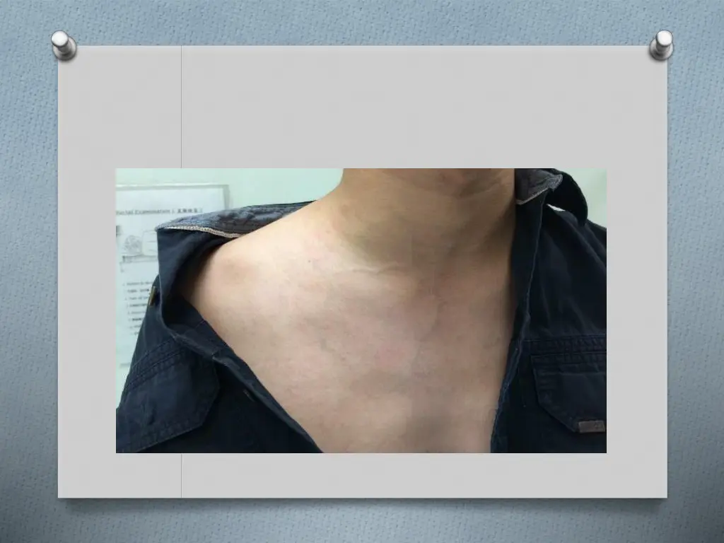 slide24