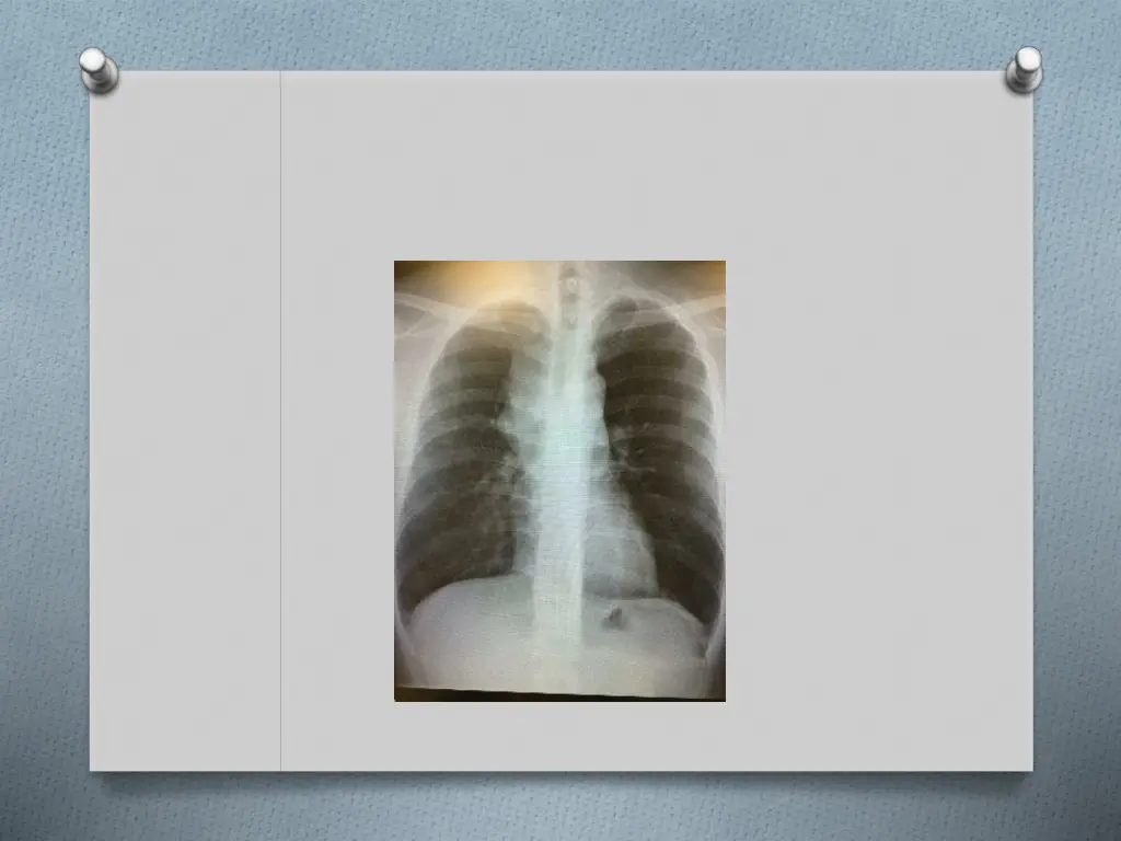 slide25