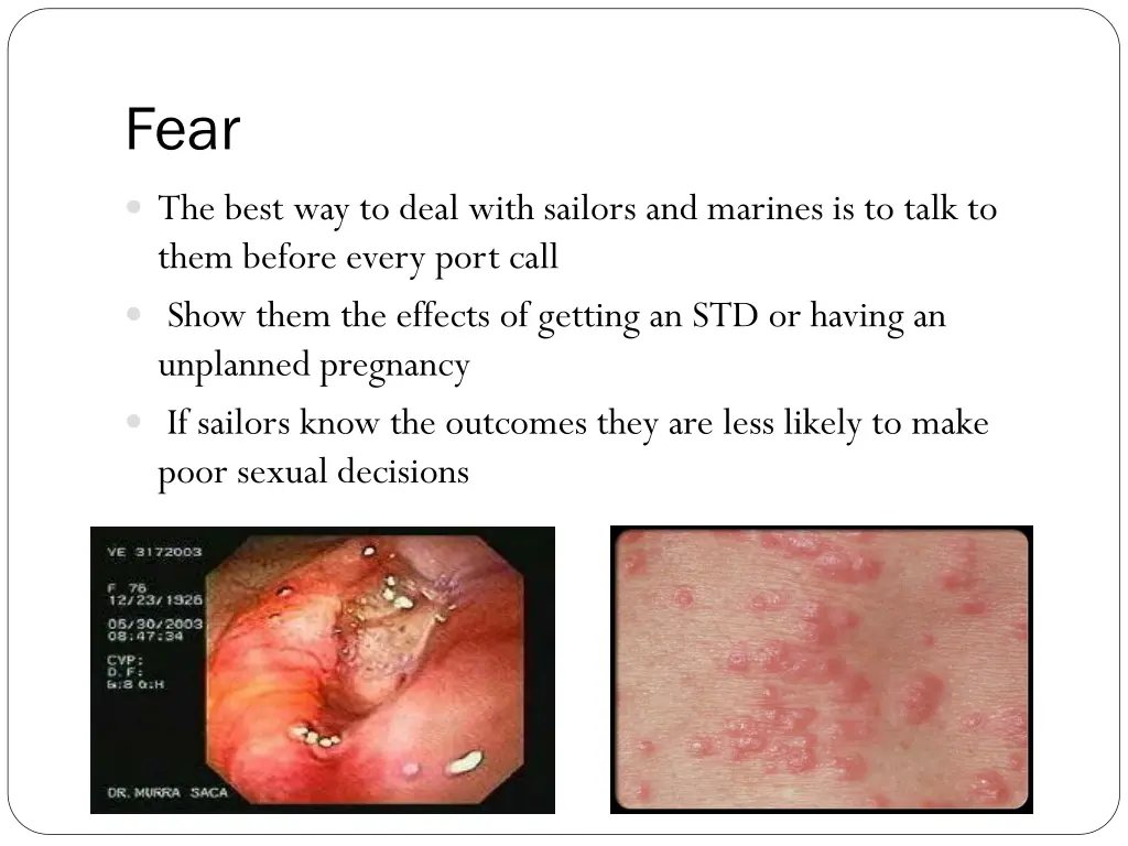 slide11