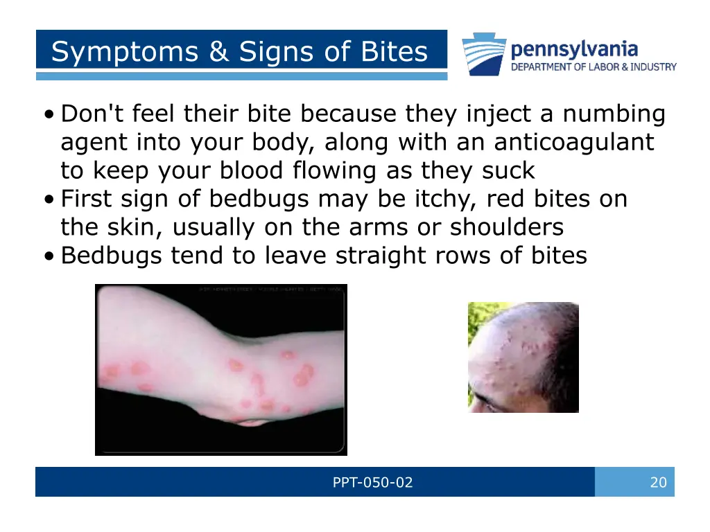 symptoms signs of bites