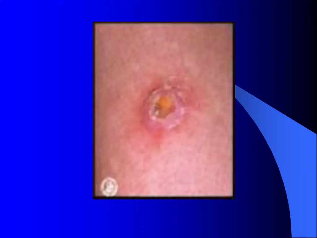 slide7