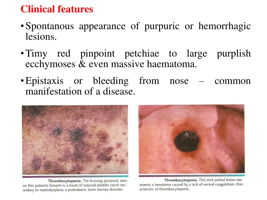 clinical features spontanous appearance