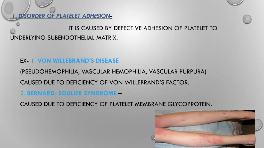 1 disorder of platelet adhesion