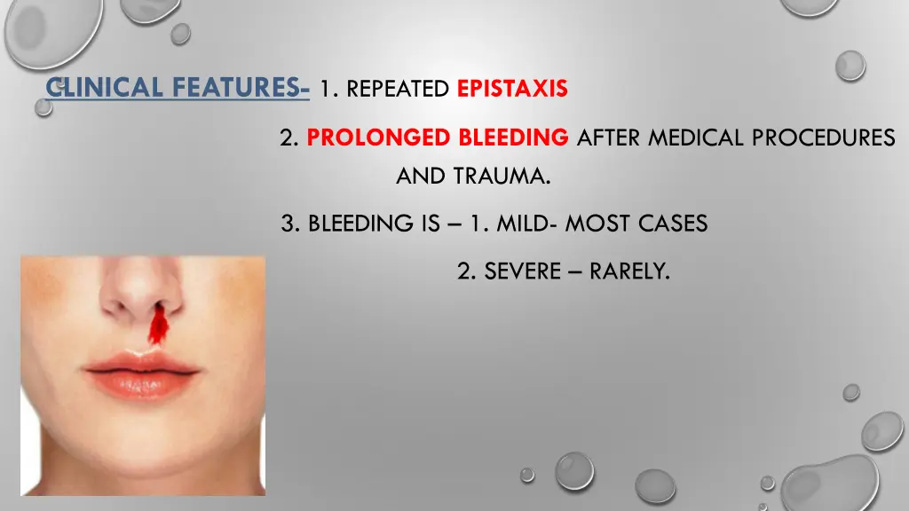 clinical features 1 repeated epistaxis