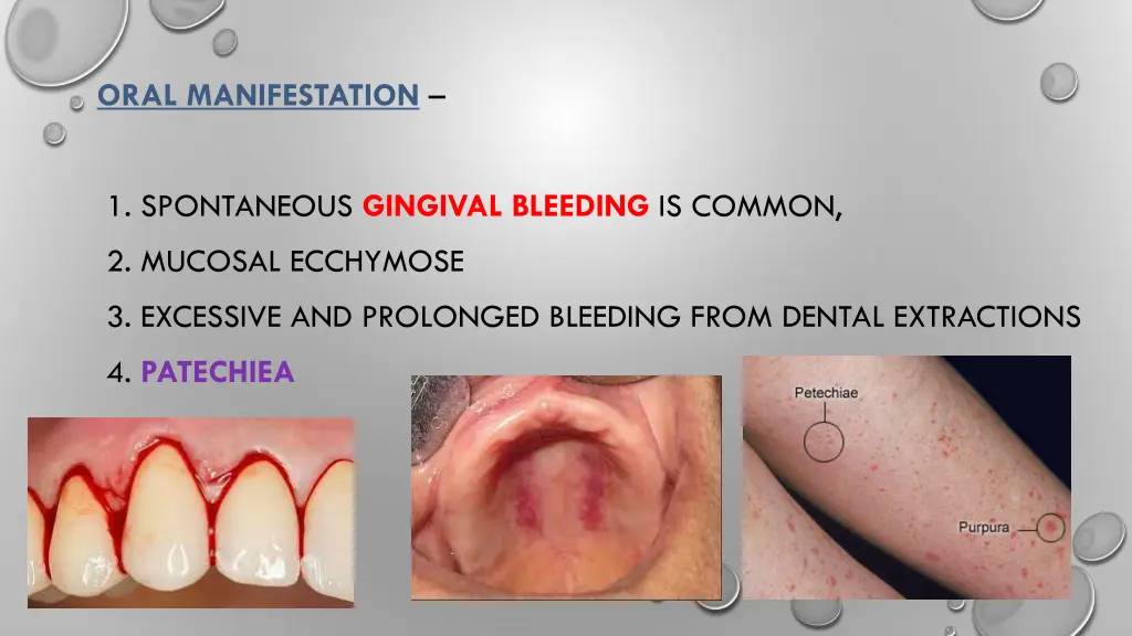oral manifestation