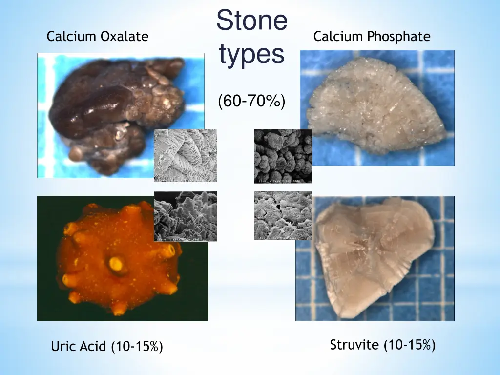 stone types