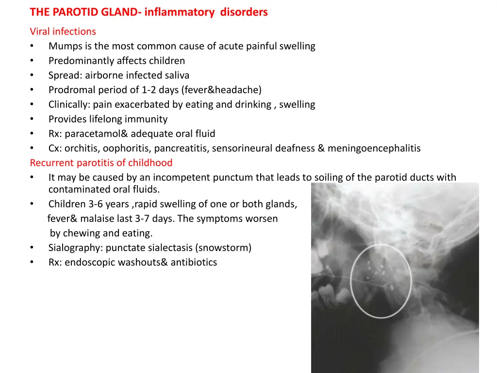 the parotid gland inflammatory disorders