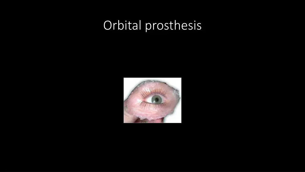orbital prosthesis