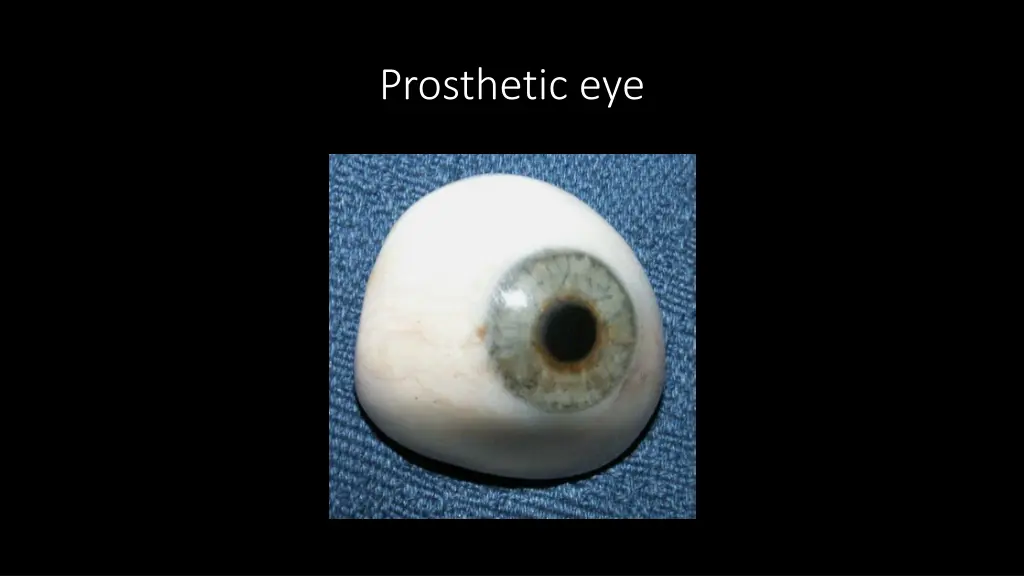 prosthetic eye