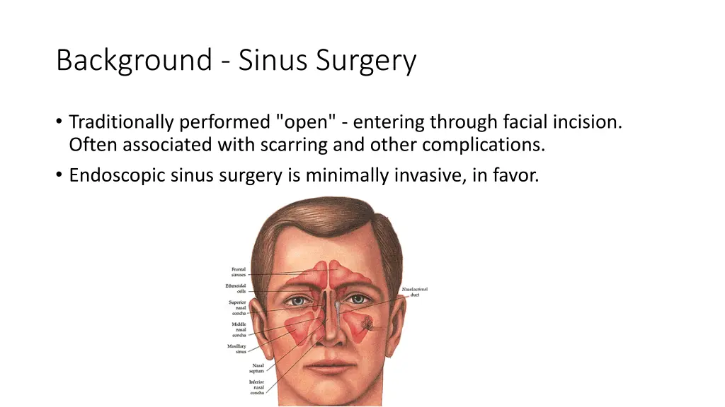 background sinus surgery