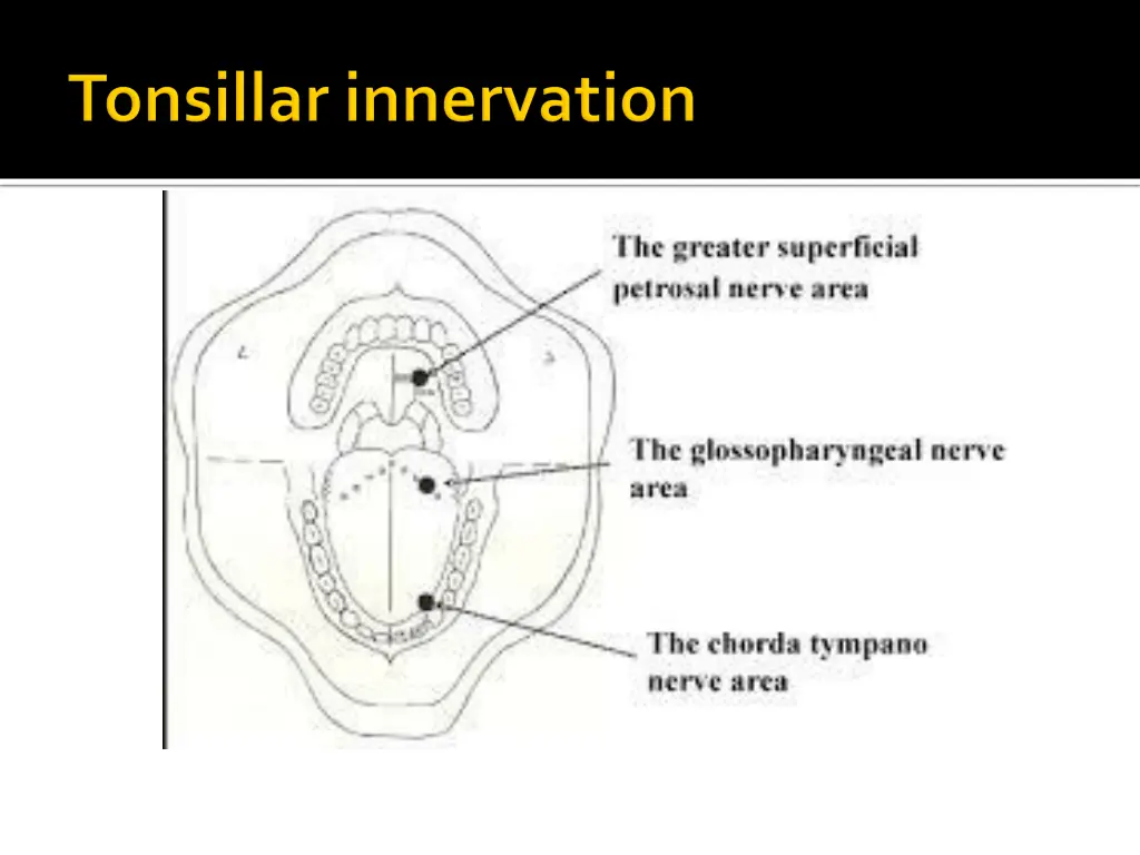 slide10