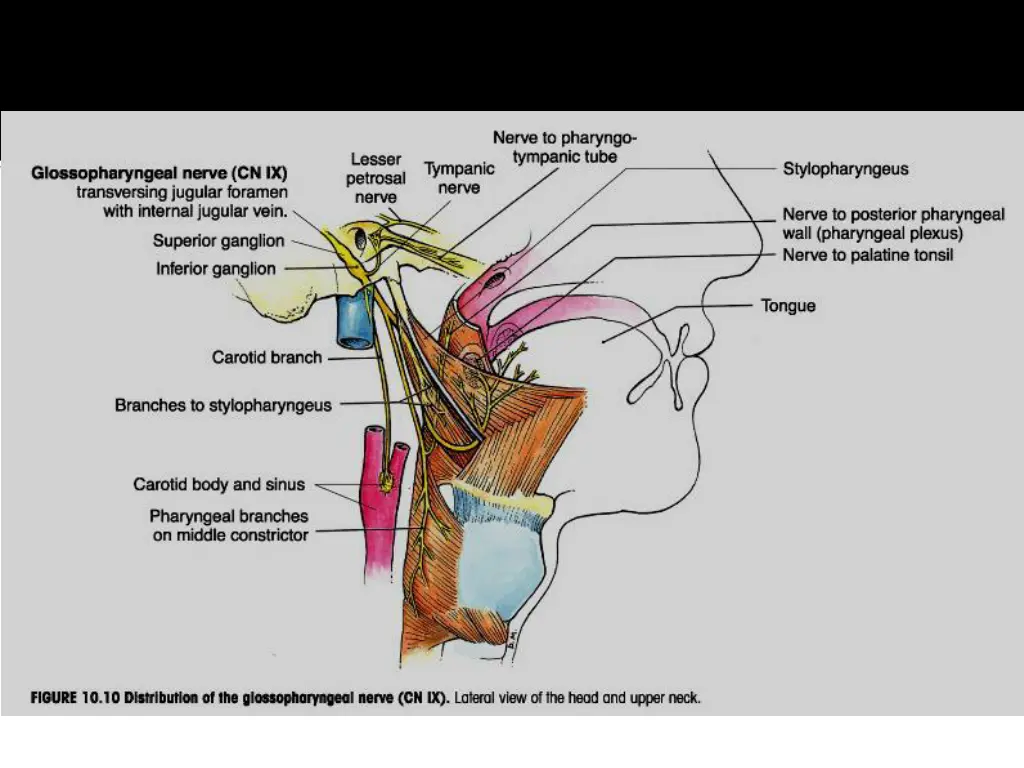 slide12