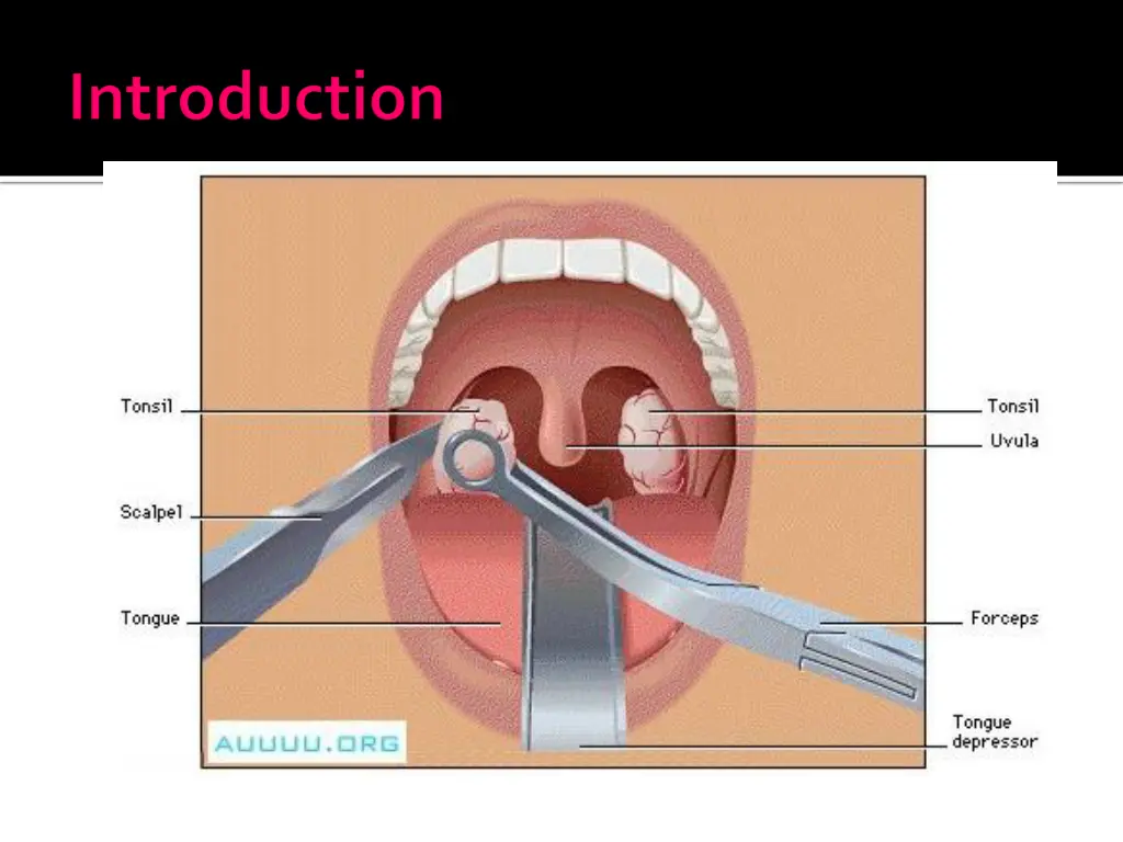 slide7