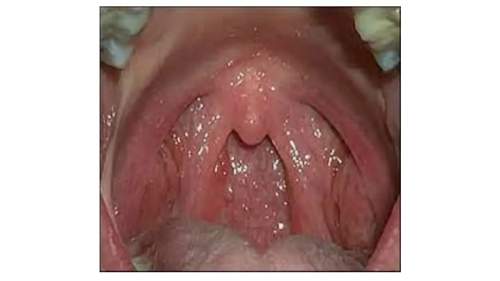 slide4