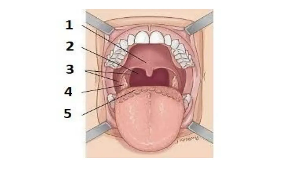 slide5