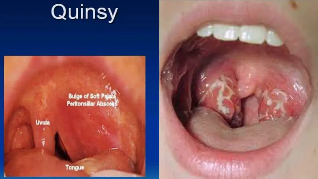 slide8