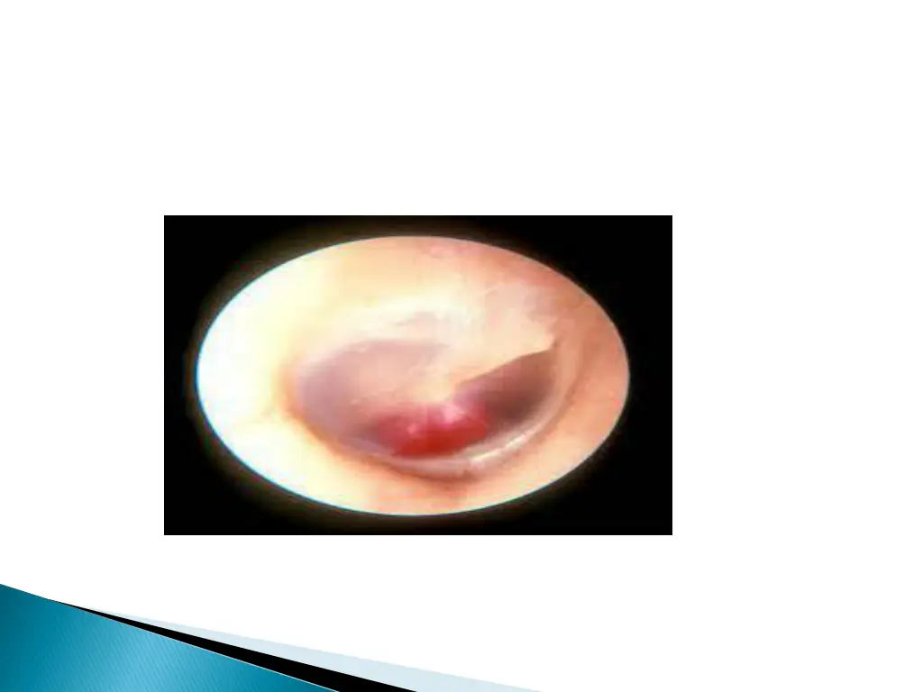slide32