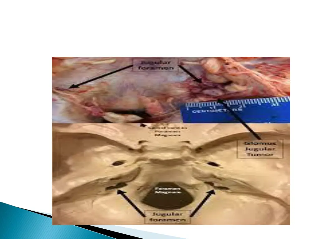slide33
