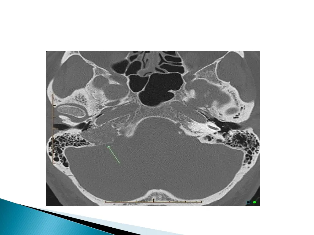 slide34