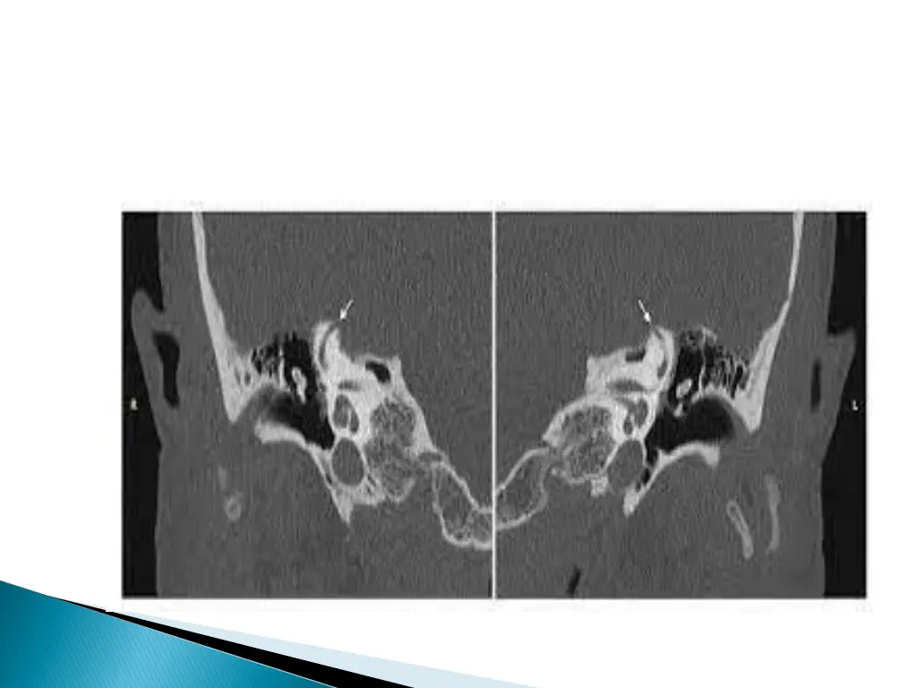 slide35