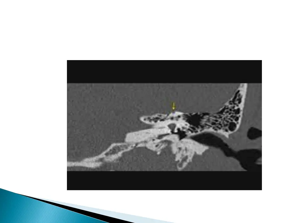 slide36