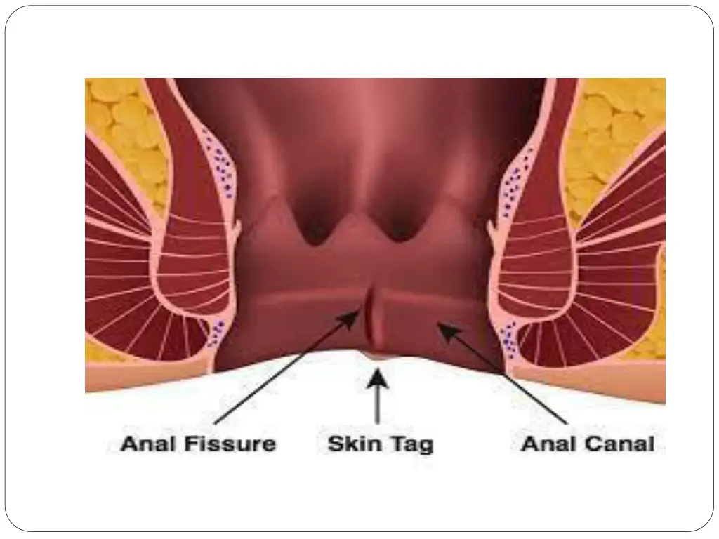 slide3