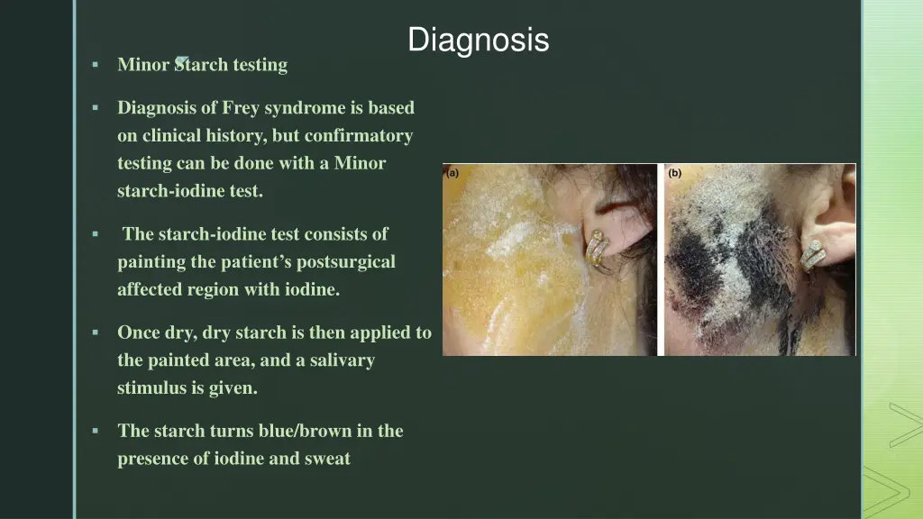 diagnosis