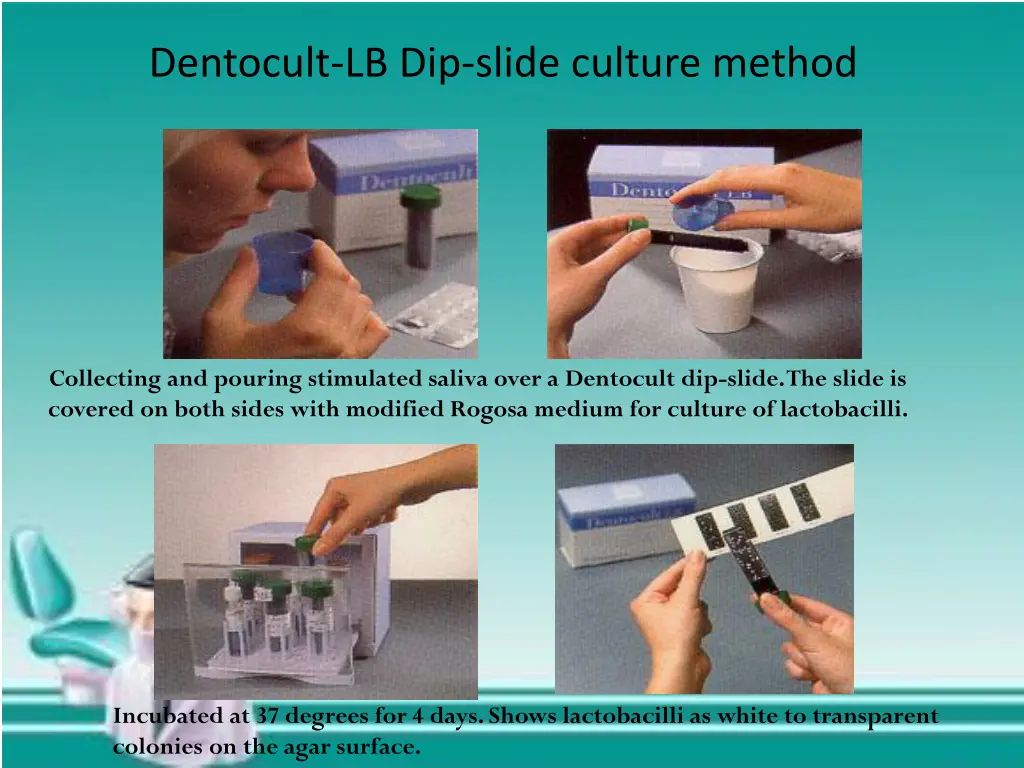 dentocult lb dip slide culture method