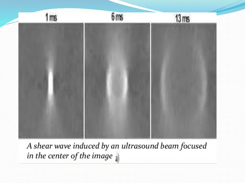 slide22