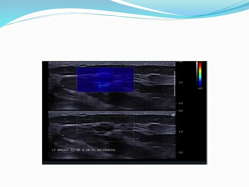 slide26