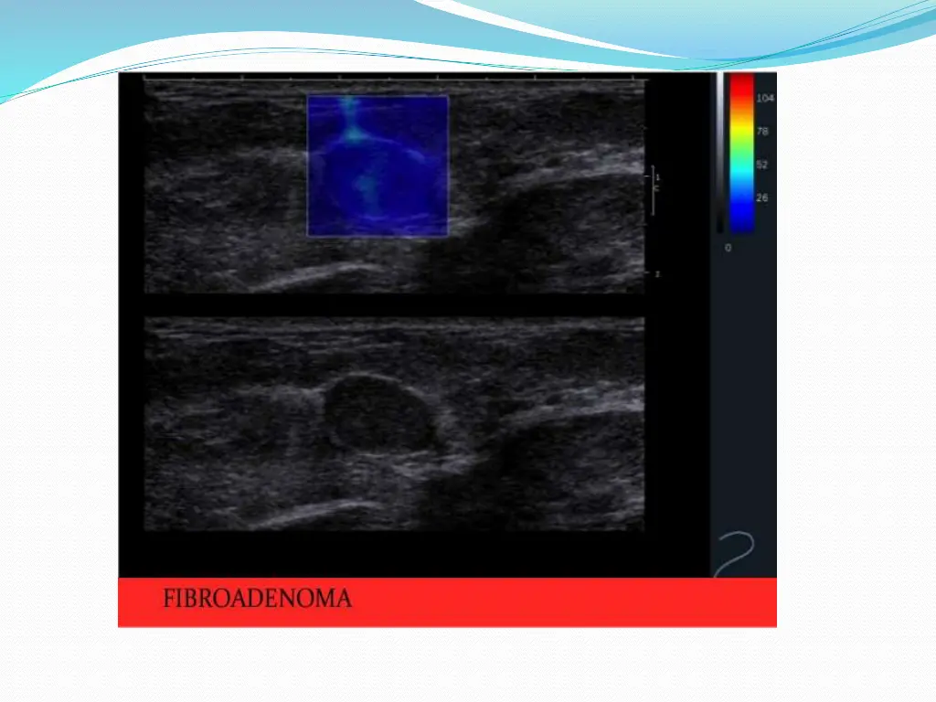slide27