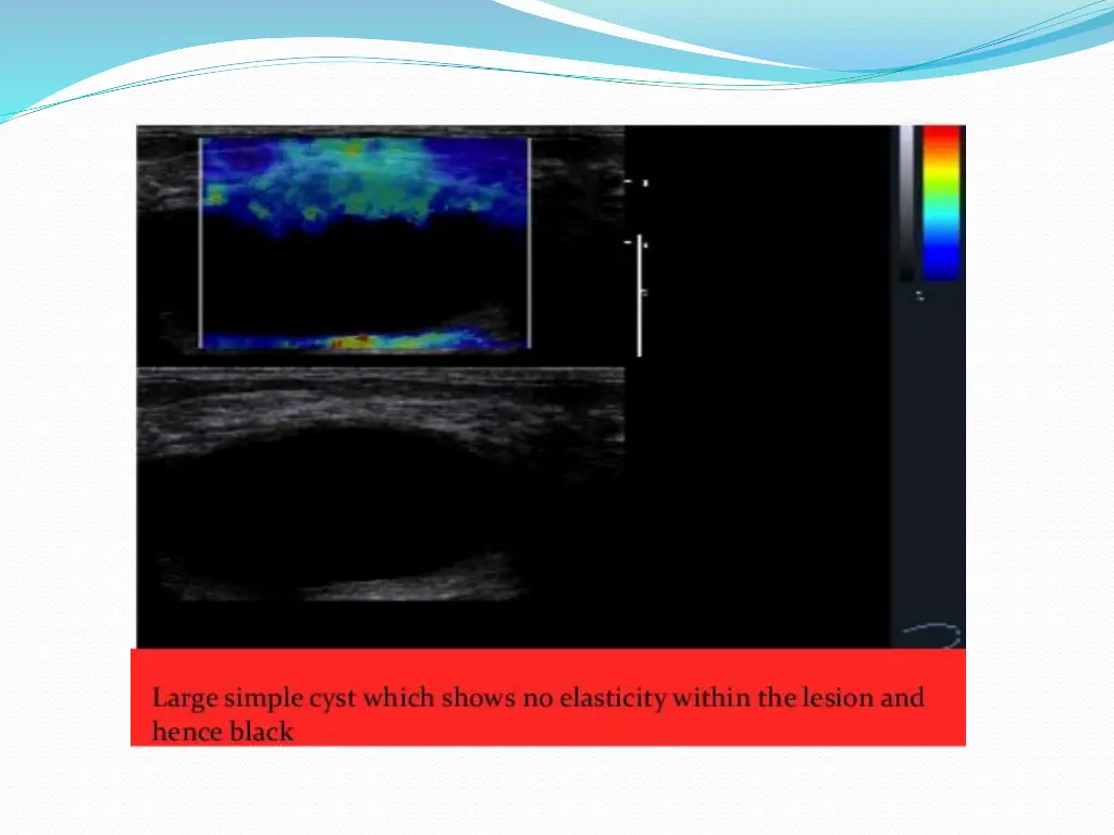 slide29