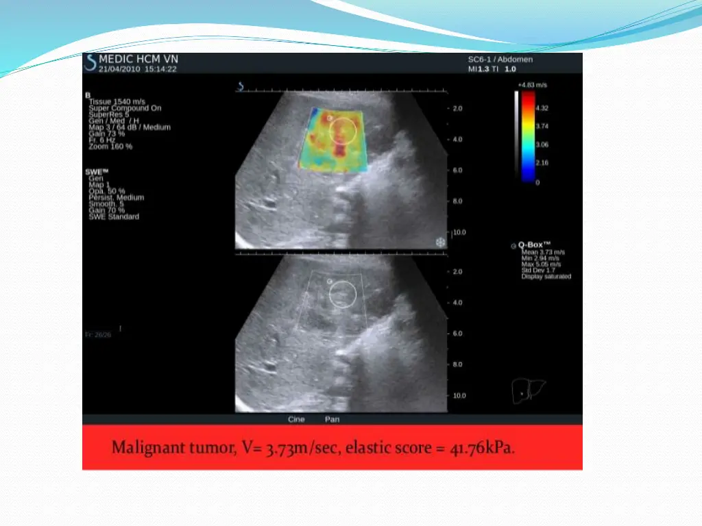 slide35