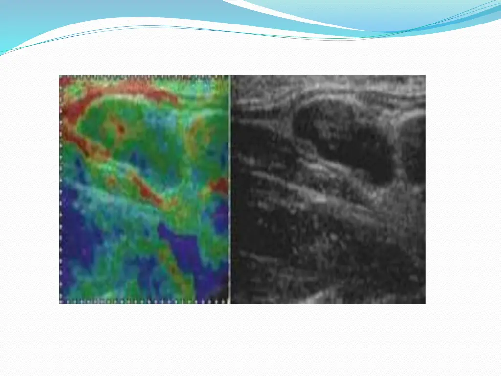 slide38
