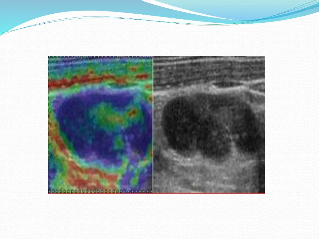 slide39