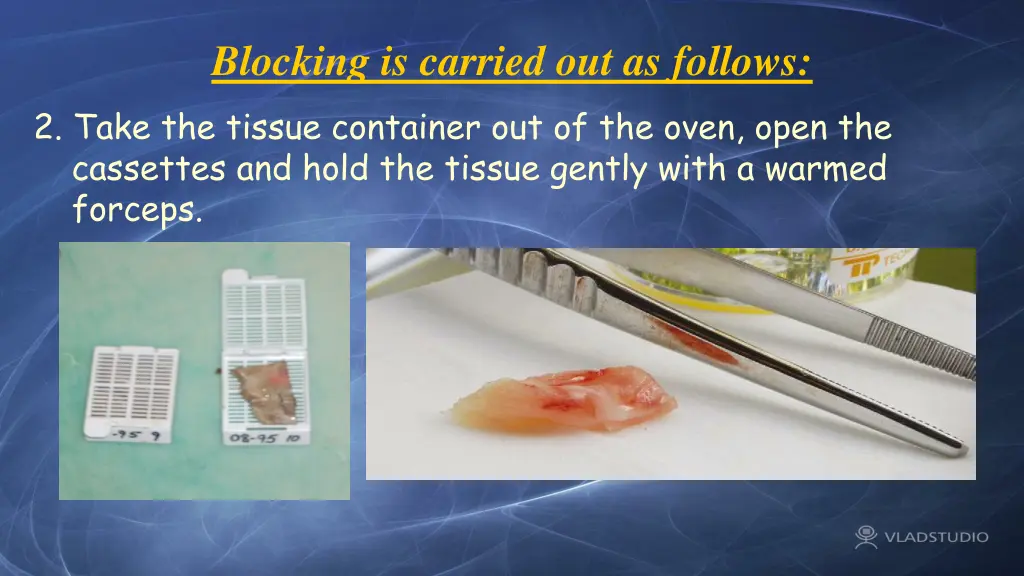blocking is carried out as follows 2 take