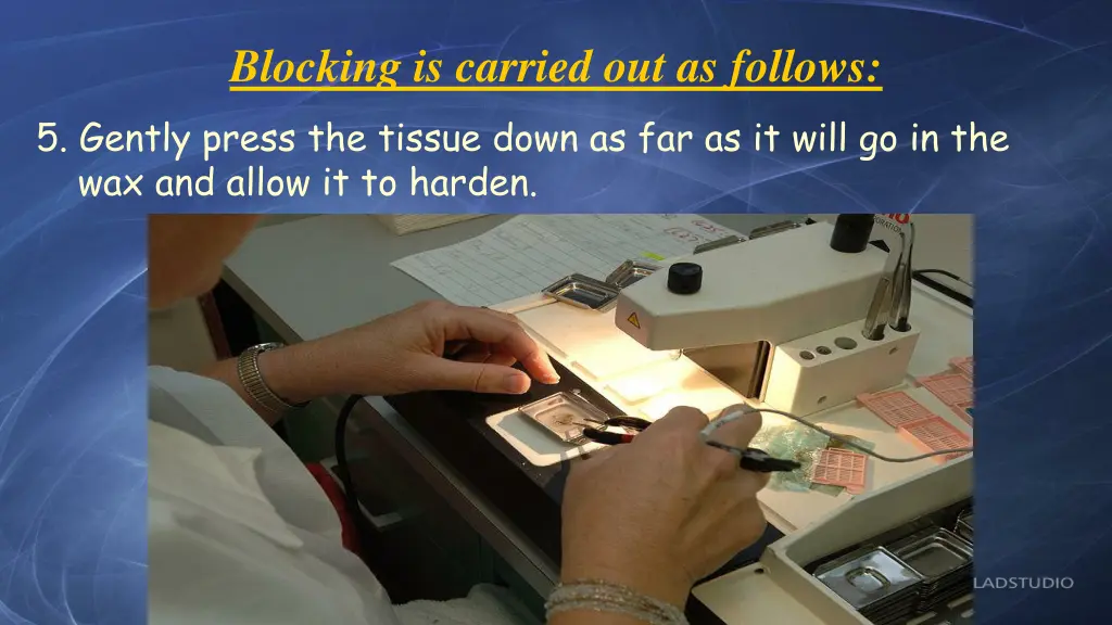 blocking is carried out as follows 5 gently press