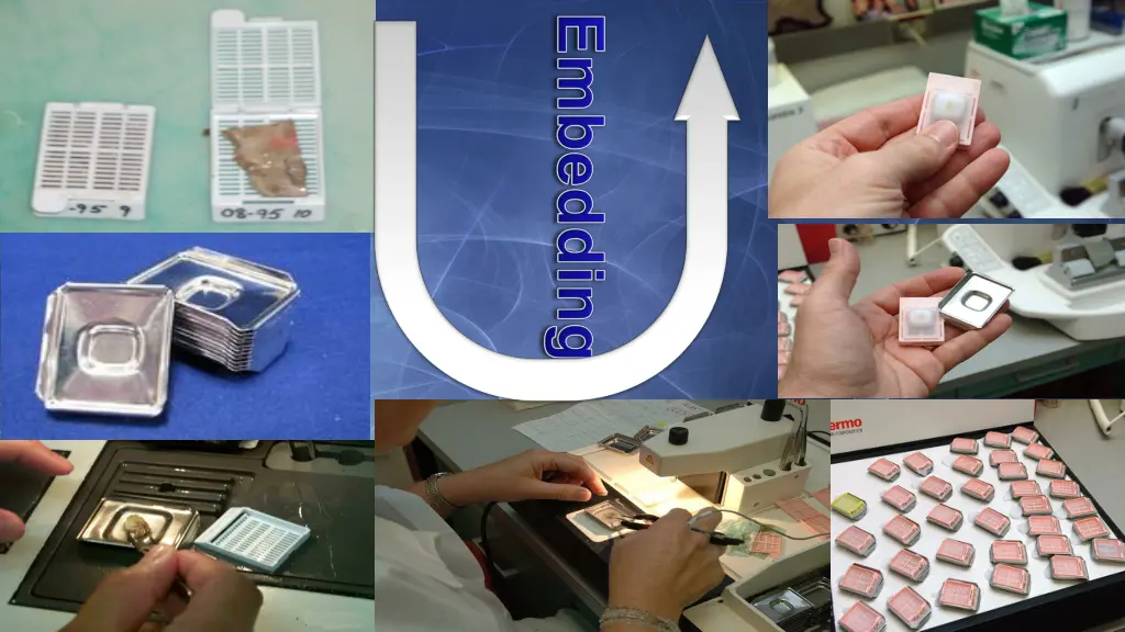 file tissue processing after metal mould 1