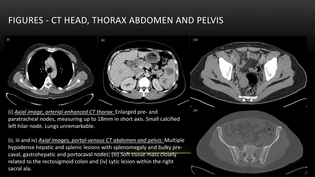 figures ct head thorax abdomen and pelvis