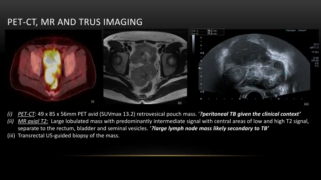 pet ct mr and trus imaging