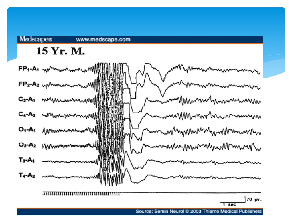 slide24