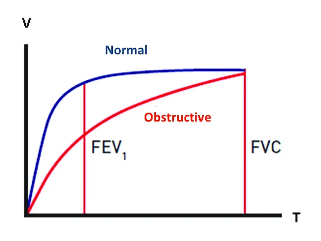slide18