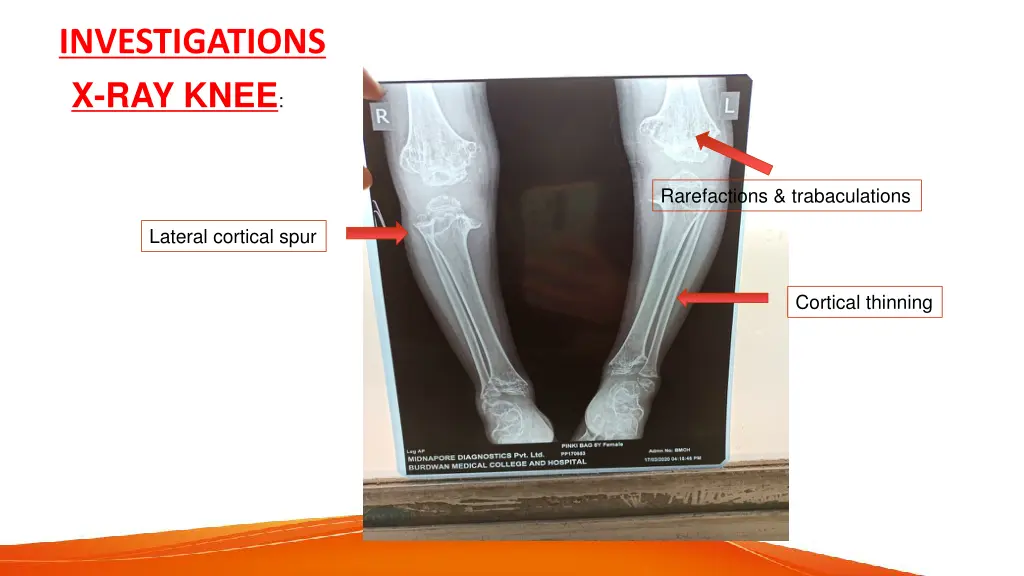 investigations x ray knee