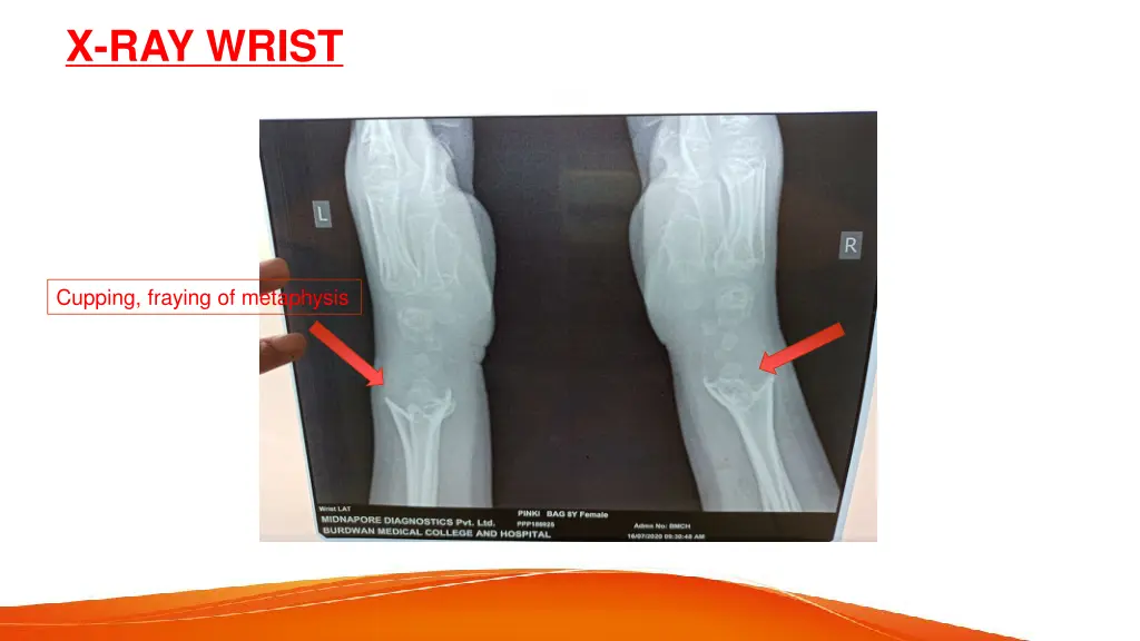 x ray wrist