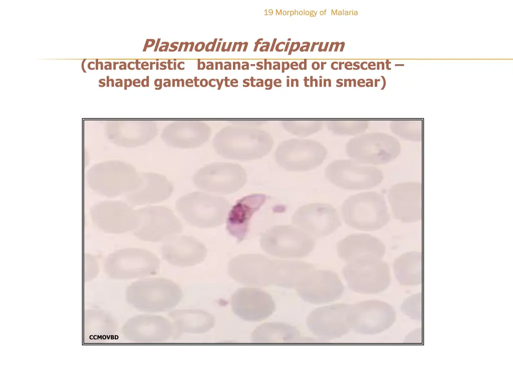 19 morphology of malaria