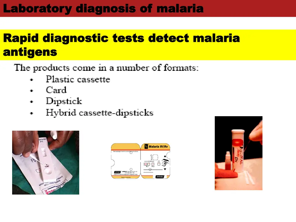 laboratory diagnosis of malaria laboratory