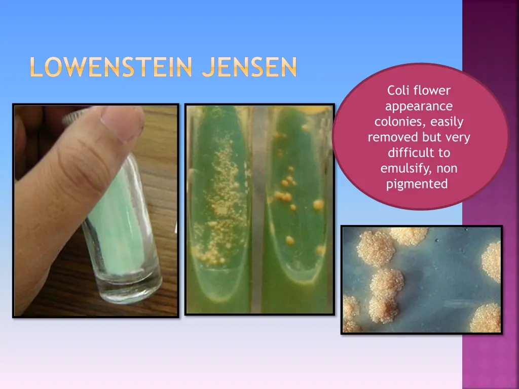 lowenstein jensen 1